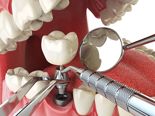 Best Cosmetic Emergency Dentistry in Pompano Beach, FL
